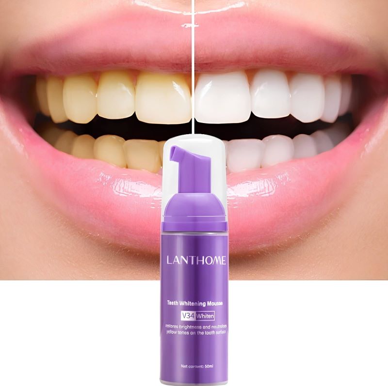 Blanqueador Dental en Crema - Práctico y Rápido